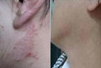 ���ݷ���Ƥ����ҽԺ