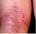 ���ݷ���Ƥ����ҽԺ