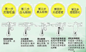 广州肤康皮肤病医院