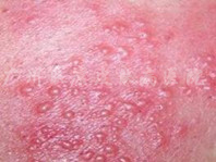 ���ݷ���Ƥ����ҽԺ