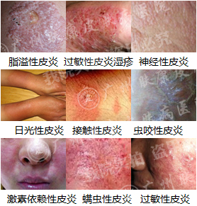 ���ݷ���Ƥ����ҽԺ