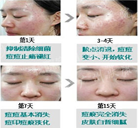 广州肤康皮肤病医院