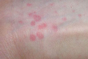 ���ݷ���Ƥ����ҽԺ