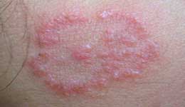 ���ݷ���Ƥ����ҽԺ